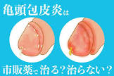 は