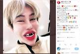 整形男子アレン