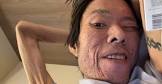 金バエ
