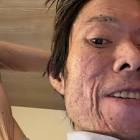 金バエ
