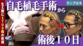 山本卓弥 (キング山本)