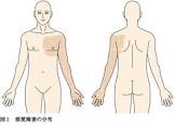 腹覚