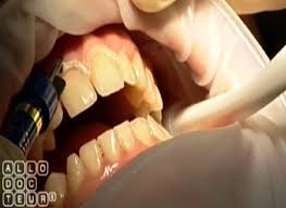 Afficher l'image en taille relle