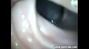 Gay camera inside ass porn videos jpg x Camera in ass