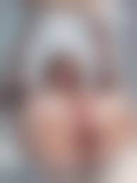 skinny legs prolapse porn|Incredible Athletic Guy Pumps up his Incredibly Huge Anal Prolapse and  Plays with it - Pornhub Gay