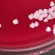 CDC: 75 Scientists Possibly Exposed to Anthrax