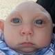 Jaxon Emmett Buell: Baby born with most of his skull missing celebrates his ... 