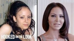 Pornstars before after surgery jpg x Before plastic surgery