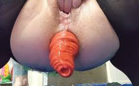Prolapse porn amateur outdoor male huge anal prolapse compilation porn perverted porn videos jpg x Rectal prolapse