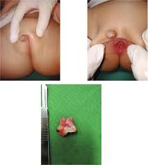 child vulva|The George Pub & Grill - Surely this cant be suitable for a 7 year old kids  home work. Ive grounded Isla for saying the words. Lol its a good debate  though,