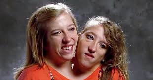 This is either two straight girls playing or the hottest conjoined twins ever porn pic eporner jpg x Conjoined twins