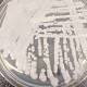CDC: Fungus Candida auris linked to death of four U.S. patients 