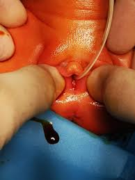child examination vagina|What to expect during a pelvic exam
