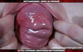 Raye prolapse jpg x Raye prolapse