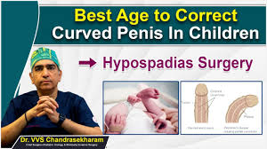 penis children|Hypospadias in children : Symptoms, causes and treatments - Guys and St  Thomas Specialist Care