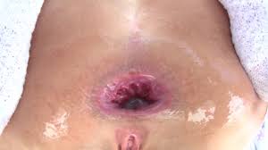 Butthole porn videos jpg x Butt hole