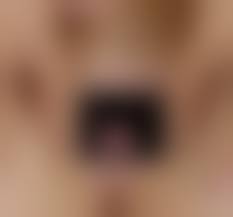 処女膜　無修正|処女膜形成 | ゆかりレディースクリニック 神戸市三宮にある婦人科