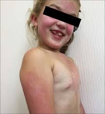 child naked girls|Vietnam Portfolio - Children