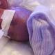 Identical Twin Born 18 Days Later Than His Brother 