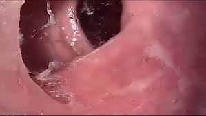 Hotkinkyjo deep anal camera expedition xo speculum amp more porn videos faphouse jpg x Anal camera