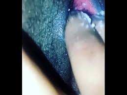 Vaginal yeast infection discharge jpg x Yeast infection