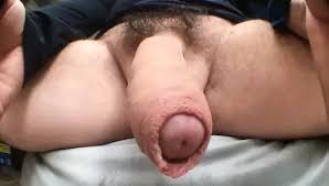 Uncut penis jpg x Uncut penis