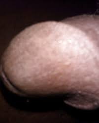 Pink head cock cumming jpg x Head dick