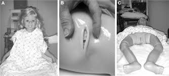 pediatric gynecology|First-in-State Fellowship-Trained Pediatric/Adolescent Gynecologist |  Featured Stories | Medical College of Wisconsin