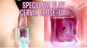 Cervix play jpg x Cervix play