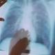 The truth about 'patient zero' and HIV's origins 