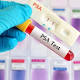 Man cured of prostate cancer after being given testosterone to shock tumors 