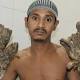 Bangladesh's 'Tree man' has his hands back 