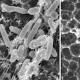 New Species of Bacteria Eats Plastic 