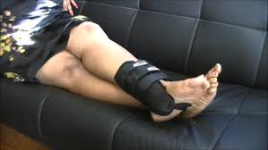 Leg cast fetish jpg x Leg cast fetish