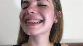 Lexi lore teens with braces fucks internet date who claims to be catfished in new porn site brace faced from team skeet jpg x Girls with braces fucking