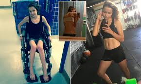 anorexic teens|How Instagram led to two teens' eating disorders | CNN