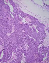 kim hee ae fake nude|https://www.e-crt.org