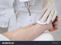 remove tattoo stock|518 Tattoo Removal Stock Photos, High-Res Pictures, and Images - Getty  Images