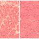 Scientists Say the Clock of Aging May Be Reversible 