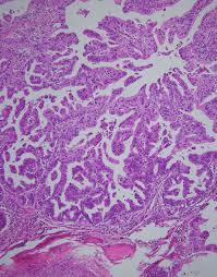 kim hyo jin fake nude|IJMS | May-1 2022 - Browse Articles