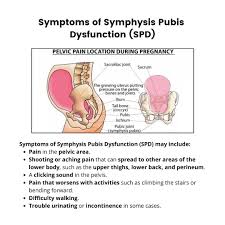 pubis spread|Pediculosis Pubis | SpringerLink