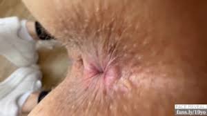 Ass hole close jpg x Ass hole close up