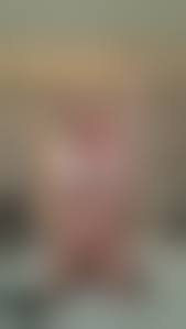 Amputee girls nude|Amputee: Nude armless girl - ThisVid.com