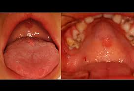 Pre pubertal girls nude |Frontiers | Effect of AMH on primordial follicle populations in mouse  ovaries and human pre-pubertal ovarian xenografts during doxorubicin  treatment