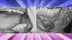 sperm on tongue|Tongue Face Mouth Lip Semen, PNG, 2736x3648px, Watercolor, Cartoon, Flower,  Frame, Heart Download Free