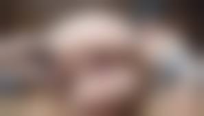 skinny legs prolapse porn|Young Anal Gape | Bizarre Amateur Skinny Girl Gaping And Big Prolapse Anus