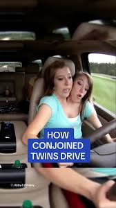 Gibk qeaeaahmff jpg x Conjoined twins