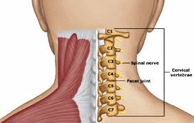 Cervical Strain - Jonathan Aarons MD/ Pain Management