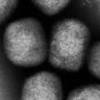 国内初確認のサル痘、検査・治療態勢は 天然痘ワクチン有効か ...