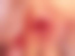 prepubertAL VAGINA|Vulvar Synechiae - Prepubertal Alert | International Journal of Clinical &  Medical Images